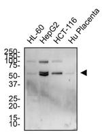 TRAIL-R2 (DR5) Antibody in Western Blot (WB)