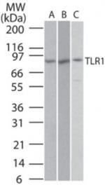 TLR1 Antibody in Western Blot (WB)