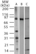 TLR2 Antibody in Western Blot (WB)