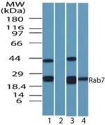 RAB7 Antibody in Western Blot (WB)