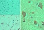 CYP1B1 Antibody in Immunohistochemistry (Paraffin) (IHC (P))