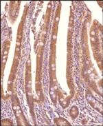 Sorcin Antibody in Immunohistochemistry (Paraffin) (IHC (P))