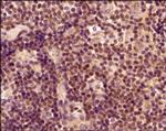 ROR gamma Antibody in Immunohistochemistry (Paraffin) (IHC (P))