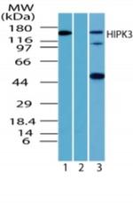 HIPK3 Antibody in Western Blot (WB)