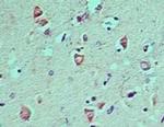 LC3A Antibody in Immunohistochemistry (Paraffin) (IHC (P))