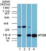 LC3A Antibody in Western Blot (WB)