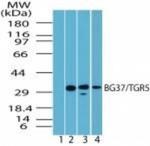 TGR5 Antibody in Western Blot (WB)