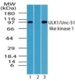 ULK1 Antibody in Western Blot (WB)