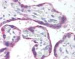 GRK5 Antibody in Immunohistochemistry (Paraffin) (IHC (P))