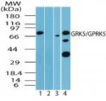 GRK5 Antibody in Western Blot (WB)