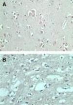 FMNL2 Antibody in Immunohistochemistry (Paraffin) (IHC (P))