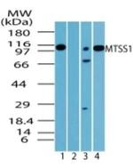 MTSS1 Antibody in Western Blot (WB)