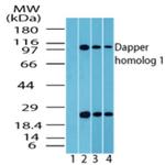 DACT1 Antibody in Western Blot (WB)