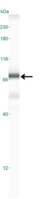 TGM2 Antibody in Western Blot (WB)