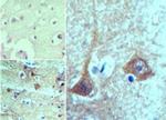 Prosapip2 Antibody in Immunohistochemistry (Paraffin) (IHC (P))