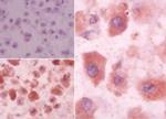 EDG3 Antibody in Immunohistochemistry (Paraffin) (IHC (P))