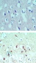 eIF4A2 Antibody in Immunohistochemistry (Paraffin) (IHC (P))