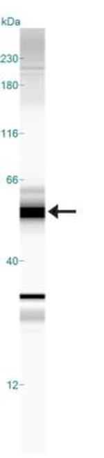 beta-Arrestin 2 Antibody in Western Blot (WB)