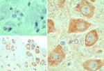 EBI3 Antibody in Immunohistochemistry (Paraffin) (IHC (P))