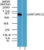 GARP Antibody in Western Blot (WB)