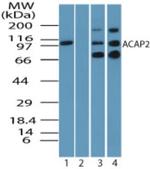 ACAP2 Antibody in Western Blot (WB)