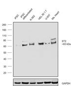 ST2 Antibody in Western Blot (WB)