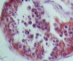 NALP9 Antibody in Immunohistochemistry (Paraffin) (IHC (P))