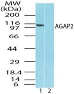 CENTG1 Antibody in Western Blot (WB)