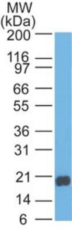 REG3A Antibody in Western Blot (WB)