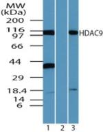 HDAC9 Antibody in Western Blot (WB)