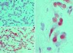 Phospho-FGFR1 (Tyr651, Tyr652) Antibody in Immunohistochemistry (Paraffin) (IHC (P))