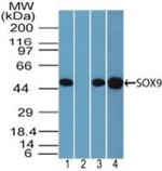 SOX9 Antibody in Western Blot (WB)