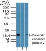 PEN2 Antibody in Western Blot (WB)