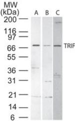 TRIF Antibody in Western Blot (WB)