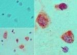 S1P1 Antibody in Immunohistochemistry (Paraffin) (IHC (P))