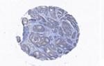 Coronin 3 Antibody in Immunohistochemistry (Paraffin) (IHC (P))