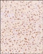 SNAIL Antibody in Immunohistochemistry (Paraffin) (IHC (P))