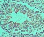 Ifi204 Antibody in Immunohistochemistry (Paraffin) (IHC (P))