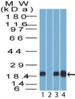 14-3-3 sigma Antibody in Western Blot (WB)