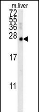 MCEE Antibody in Western Blot (WB)