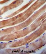 KEAP1 Antibody in Immunohistochemistry (Paraffin) (IHC (P))