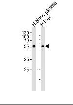 Fetuin A Antibody in Western Blot (WB)