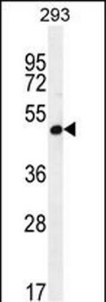 A4GALT Antibody in Western Blot (WB)