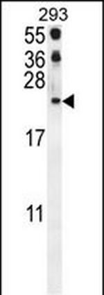 CCL21 Antibody in Western Blot (WB)