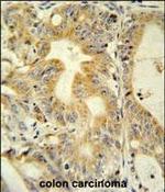 DcR3 Antibody in Immunohistochemistry (Paraffin) (IHC (P))