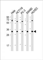 DcR3 Antibody in Western Blot (WB)