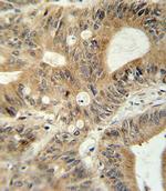 MRP3 Antibody in Immunohistochemistry (Paraffin) (IHC (P))