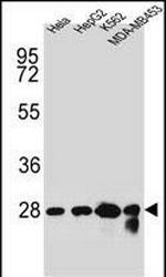 CHPT1 Antibody in Western Blot (WB)