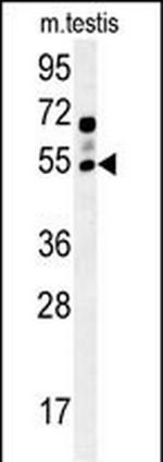 GABRG2 Antibody in Western Blot (WB)