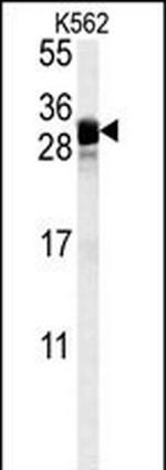 KGF Antibody in Western Blot (WB)